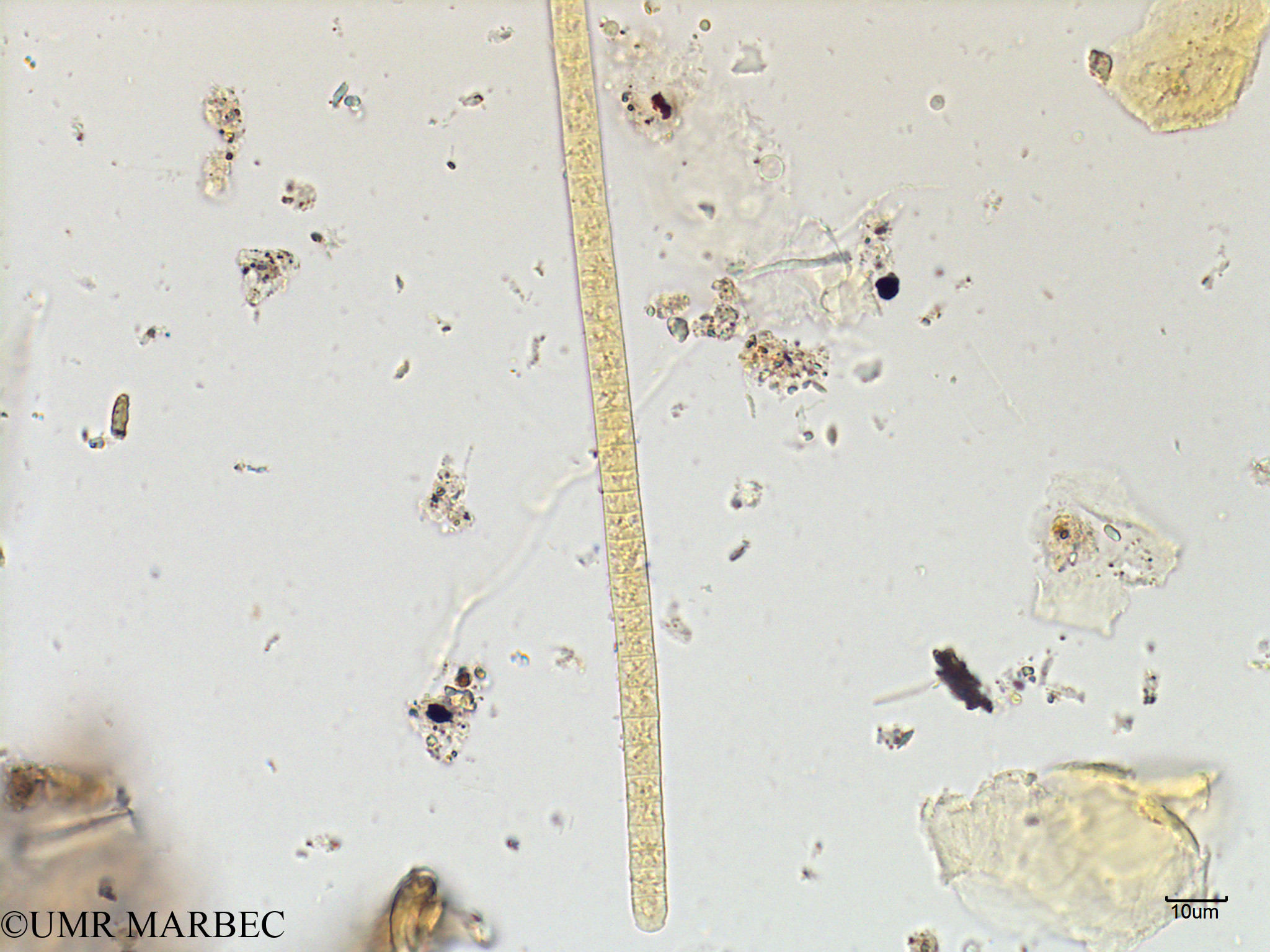 phyto/Scattered_Islands/mayotte_lagoon/SIREME May 2016/Trichodesmium sp4 (MAY2_trichodesmium-5).tif(copy).jpg